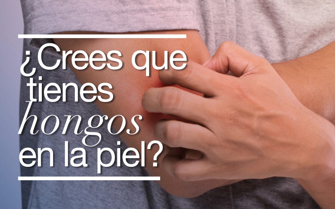 ¿Crees que tienes hongos en la piel?