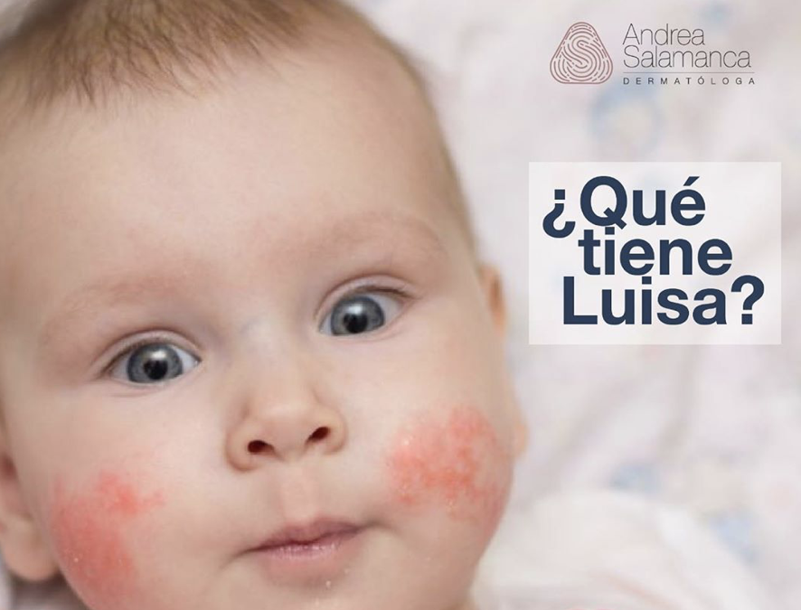 ¿Qué tiene Luisa?