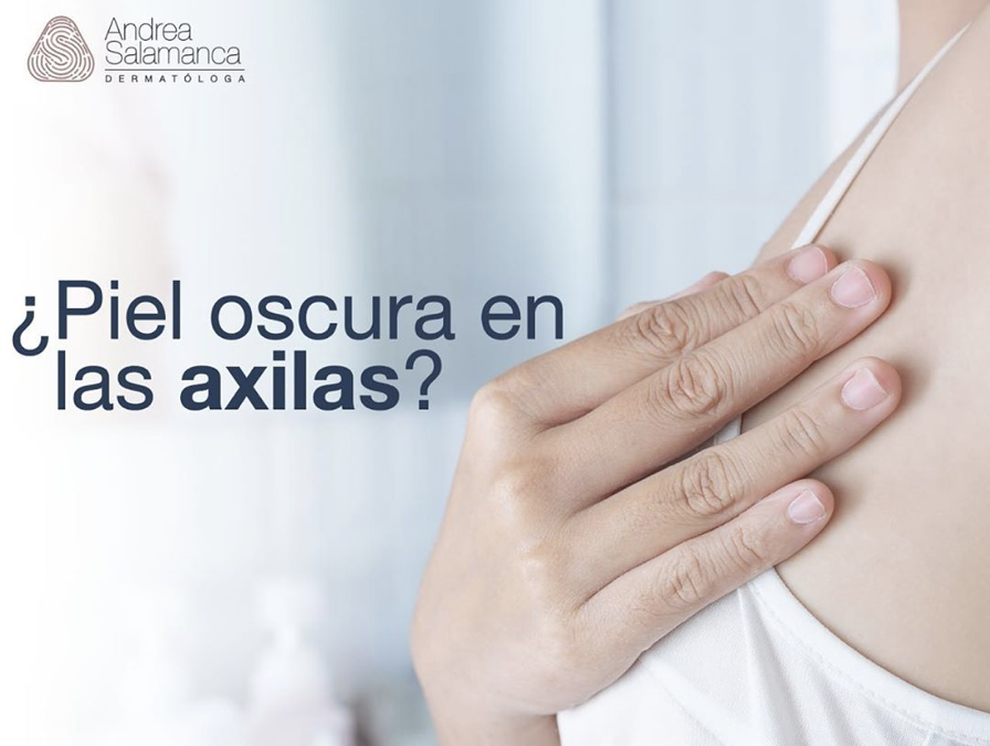 ¿Piel oscura en axilas?