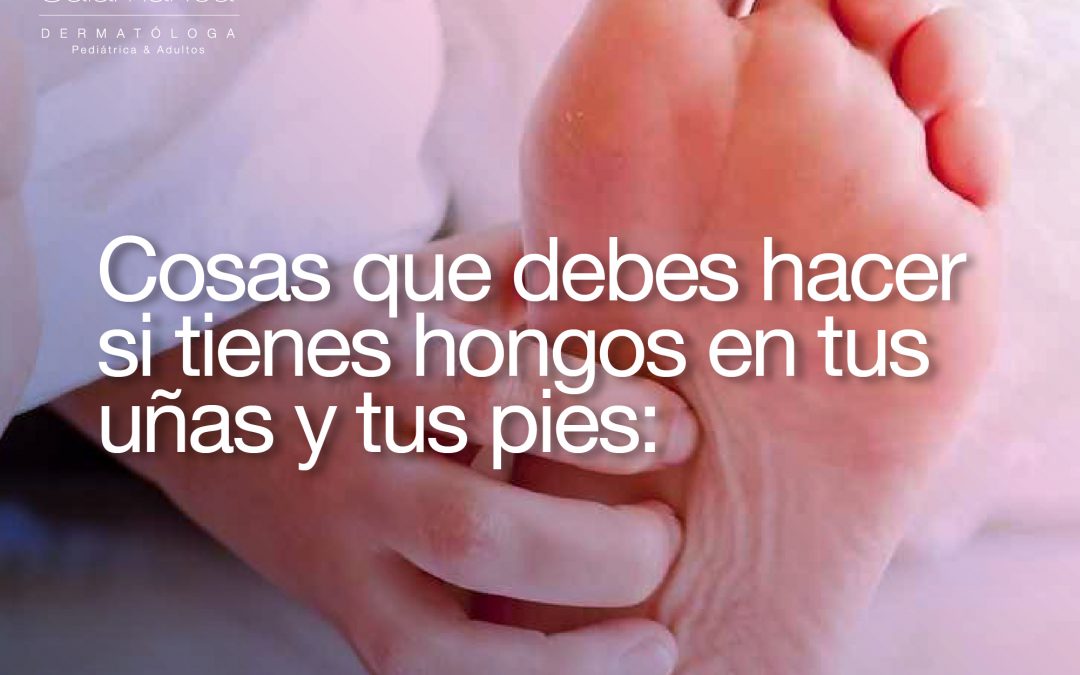 ¿Hongos en los pies?