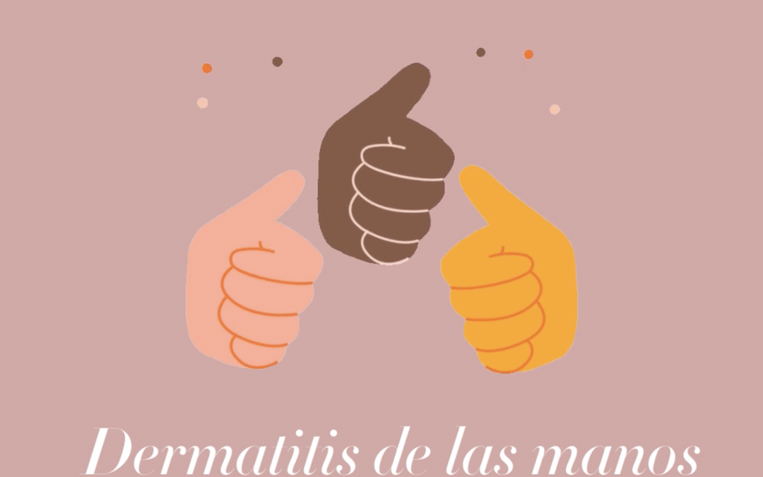 ¿Dermatitis en la manos?