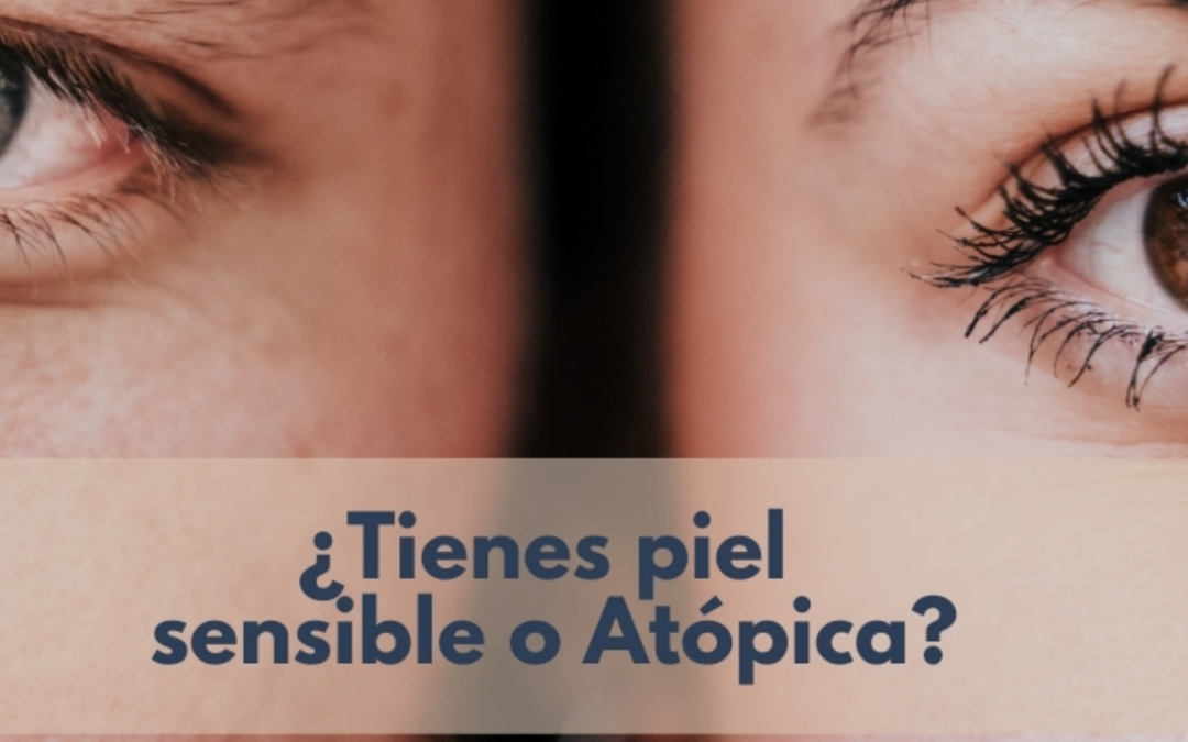 ¿Tienes la piel sensible o atópica?