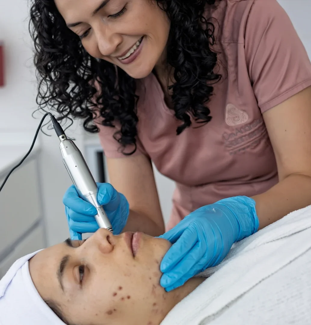 Procedimiento dermatológico como parte del manejo individual de la piel