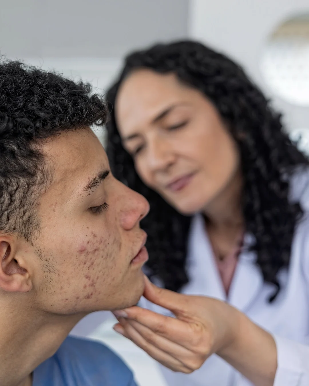 Valoración dermatológica de paciente joven con acné en Bogotá